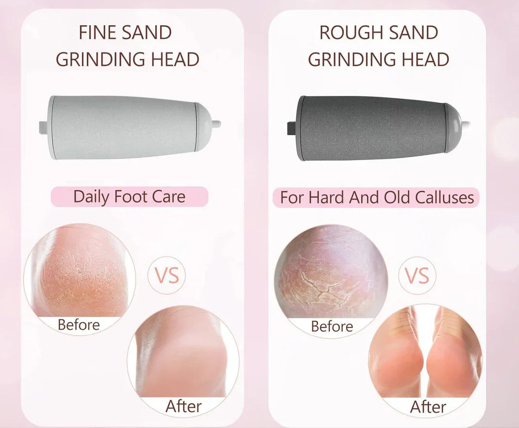 Rechargeable Electric Foot Callus Remover